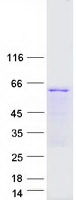 TCP11 Protein - Purified recombinant protein TCP11 was analyzed by SDS-PAGE gel and Coomassie Blue Staining