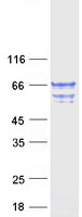 TCP11L2 Protein - Purified recombinant protein TCP11L2 was analyzed by SDS-PAGE gel and Coomassie Blue Staining
