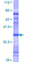 TCTE3 Protein - 12.5% SDS-PAGE Stained with Coomassie Blue.