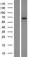 TCTN1 Protein - Western validation with an anti-DDK antibody * L: Control HEK293 lysate R: Over-expression lysate