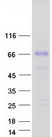TCTN1 Protein - Purified recombinant protein TCTN1 was analyzed by SDS-PAGE gel and Coomassie Blue Staining