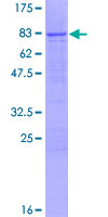 TDG / Thymine DNA Glycosylase Protein - 12.5% SDS-PAGE of human TDG stained with Coomassie Blue
