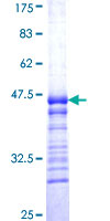 TDG / Thymine DNA Glycosylase Protein - 12.5% SDS-PAGE Stained with Coomassie Blue.