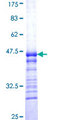 TDG / Thymine DNA Glycosylase Protein - 12.5% SDS-PAGE Stained with Coomassie Blue.