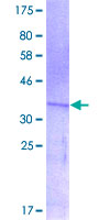 TDO2 Protein - 12.5% SDS-PAGE Stained with Coomassie Blue.