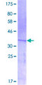 TDO2 Protein - 12.5% SDS-PAGE Stained with Coomassie Blue.