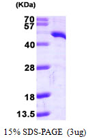 TDO2 Protein