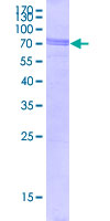 TDP-43 / TARDBP Protein - 12.5% SDS-PAGE of human TARDBP stained with Coomassie Blue