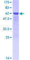 TDP-43 / TARDBP Protein - 12.5% SDS-PAGE Stained with Coomassie Blue.
