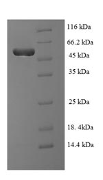 TDP-43 / TARDBP Protein - (Tris-Glycine gel) Discontinuous SDS-PAGE (reduced) with 5% enrichment gel and 15% separation gel.