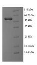TDP-43 / TARDBP Protein - (Tris-Glycine gel) Discontinuous SDS-PAGE (reduced) with 5% enrichment gel and 15% separation gel.