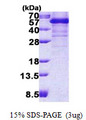 TDP-43 / TARDBP Protein