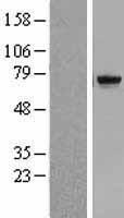 TDP1 Protein - Western validation with an anti-DDK antibody * L: Control HEK293 lysate R: Over-expression lysate