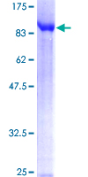 TDP1 Protein - 12.5% SDS-PAGE of human TDP1 stained with Coomassie Blue