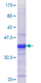 TDP1 Protein - 12.5% SDS-PAGE Stained with Coomassie Blue.