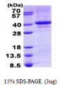 TDP1 Protein