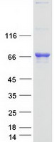 TDP1 Protein - Purified recombinant protein TDP1 was analyzed by SDS-PAGE gel and Coomassie Blue Staining