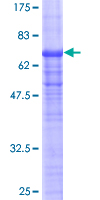 TDP2 / TTRAP Protein - 12.5% SDS-PAGE of human TTRAP stained with Coomassie Blue