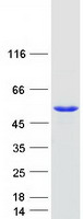 TDP2 / TTRAP Protein - Purified recombinant protein TDP2 was analyzed by SDS-PAGE gel and Coomassie Blue Staining