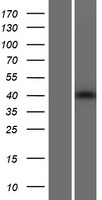 TDRD10 Protein - Western validation with an anti-DDK antibody * L: Control HEK293 lysate R: Over-expression lysate