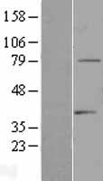 TDRD3 Protein - Western validation with an anti-DDK antibody * L: Control HEK293 lysate R: Over-expression lysate
