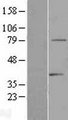 TDRD3 Protein - Western validation with an anti-DDK antibody * L: Control HEK293 lysate R: Over-expression lysate