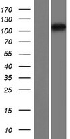 TDRD5 Protein - Western validation with an anti-DDK antibody * L: Control HEK293 lysate R: Over-expression lysate