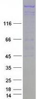 TDRD6 Protein - Purified recombinant protein TDRD6 was analyzed by SDS-PAGE gel and Coomassie Blue Staining
