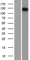 TDRD7 Protein - Western validation with an anti-DDK antibody * L: Control HEK293 lysate R: Over-expression lysate