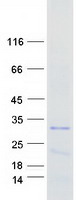 TDRP Protein - Purified recombinant protein TDRP was analyzed by SDS-PAGE gel and Coomassie Blue Staining
