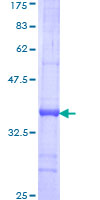 TEAD2 Protein - 12.5% SDS-PAGE Stained with Coomassie Blue.