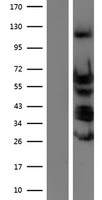 TEAD4 Protein - Western validation with an anti-DDK antibody * L: Control HEK293 lysate R: Over-expression lysate