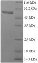 TEAD4 Protein - (Tris-Glycine gel) Discontinuous SDS-PAGE (reduced) with 5% enrichment gel and 15% separation gel.