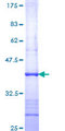 TEC Protein - 12.5% SDS-PAGE Stained with Coomassie Blue.
