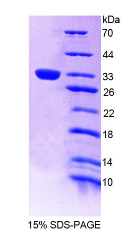TEC Protein - Recombinant Tec Protein Tyrosine Kinase By SDS-PAGE