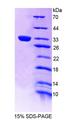 TEC Protein - Recombinant Tec Protein Tyrosine Kinase By SDS-PAGE