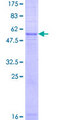 TECR / TER Protein - 12.5% SDS-PAGE of human GPSN2 stained with Coomassie Blue