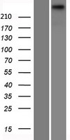 TECTA Protein - Western validation with an anti-DDK antibody * L: Control HEK293 lysate R: Over-expression lysate