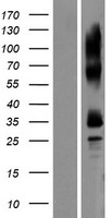 TEDDM1 Protein - Western validation with an anti-DDK antibody * L: Control HEK293 lysate R: Over-expression lysate
