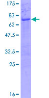 TEF Protein - 12.5% SDS-PAGE of human TEF stained with Coomassie Blue