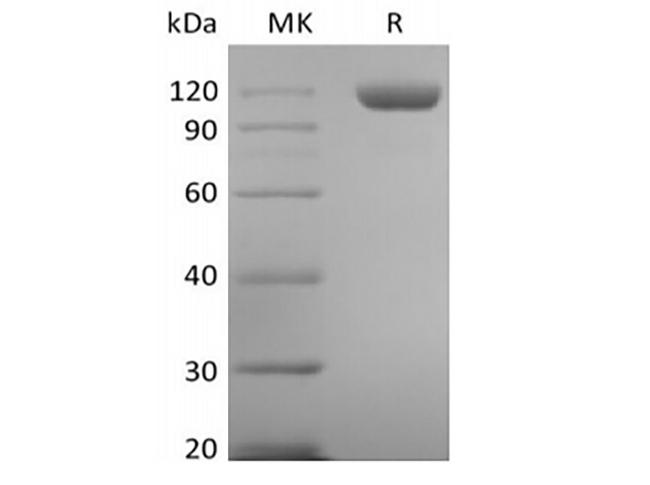 TEK / TIE2 Protein - Recombinant Human Tie-2 (C-6His)