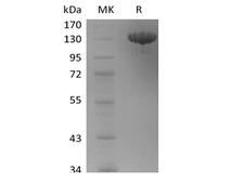 TEK / TIE2 Protein - Recombinant Human Tie-2 (C-Fc)