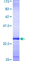 TEK / TIE2 Protein - 12.5% SDS-PAGE Stained with Coomassie Blue.