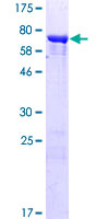 TEKT4 Protein - 12.5% SDS-PAGE of human TEKT4 stained with Coomassie Blue