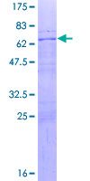 TEL-2 / ETV7 Protein - 12.5% SDS-PAGE of human ETV7 stained with Coomassie Blue