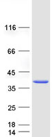 TEL-2 / ETV7 Protein - Purified recombinant protein ETV7 was analyzed by SDS-PAGE gel and Coomassie Blue Staining