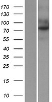 TEM1 / CD248 Protein - Western validation with an anti-DDK antibody * L: Control HEK293 lysate R: Over-expression lysate