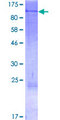 TEM1 / CD248 Protein - 12.5% SDS-PAGE of human CD248 stained with Coomassie Blue