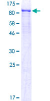 TEM1 / CD248 Protein - 12.5% SDS-PAGE of human CD248 stained with Coomassie Blue