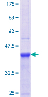 TEM1 / CD248 Protein - 12.5% SDS-PAGE Stained with Coomassie Blue